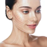 Mujer con líneas de tratamiento en la cara